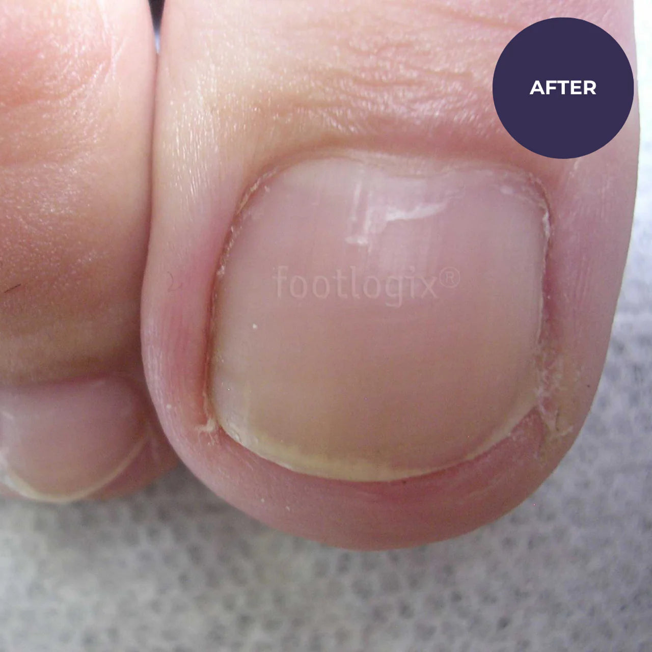 Footlogix Toe Nail Tincture (50ml)